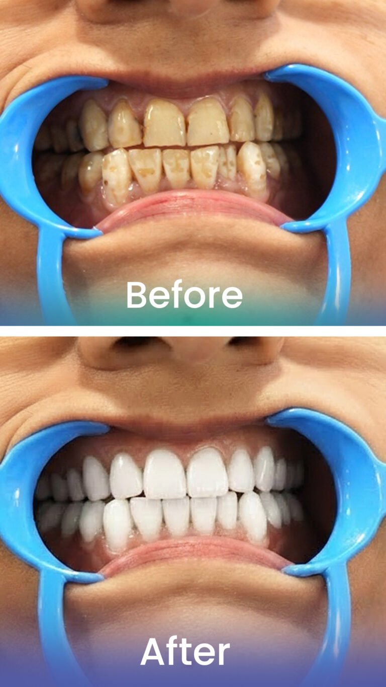 Before and after smile