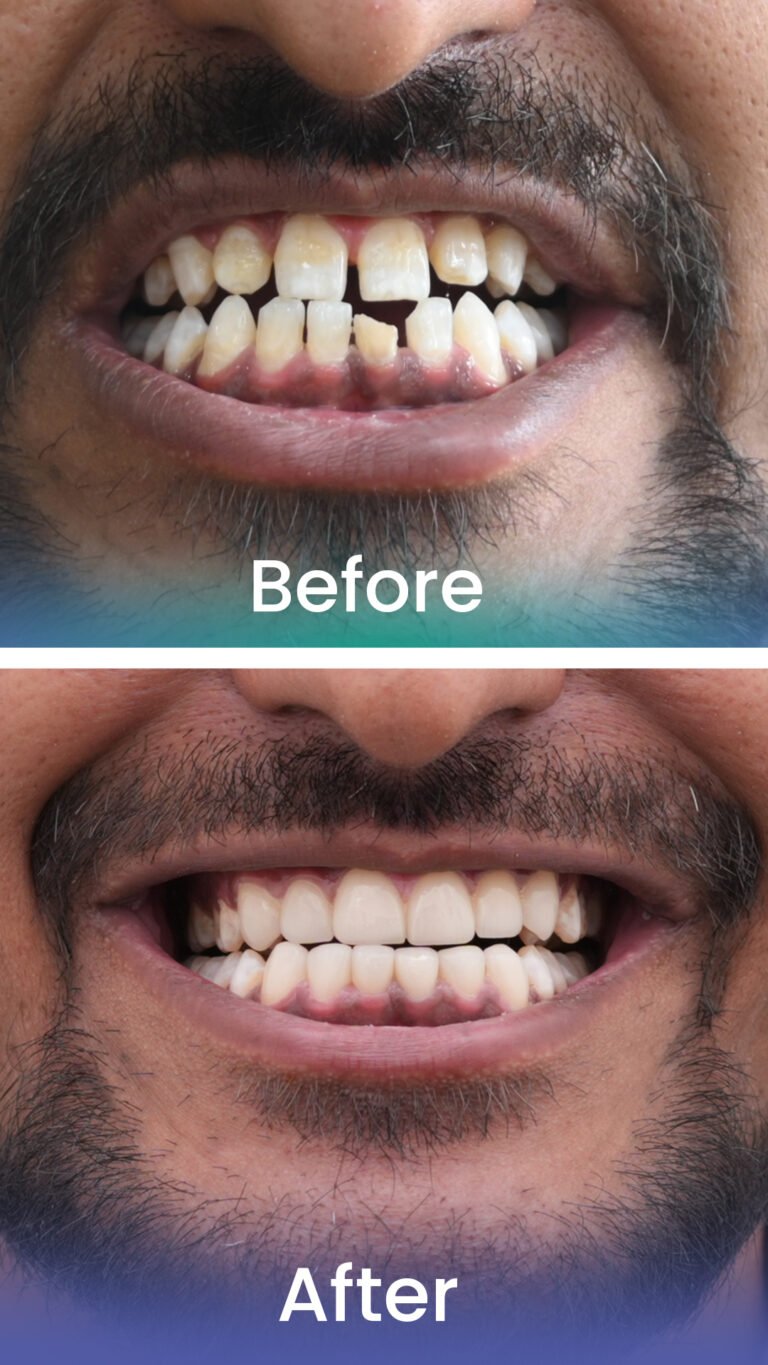 Before and after: cosmetic transformation
