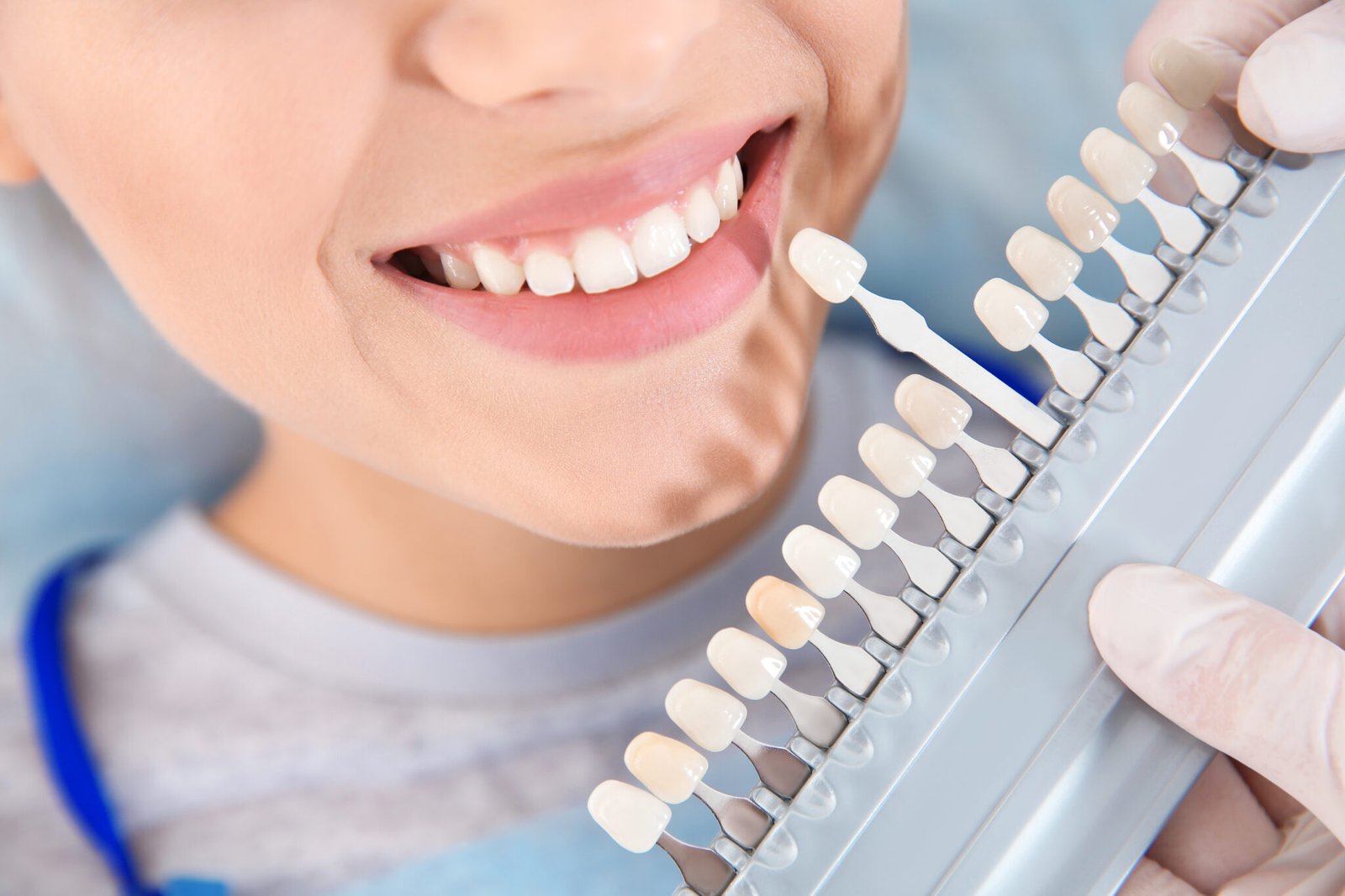 A dentist matching a tooth shade with a patient